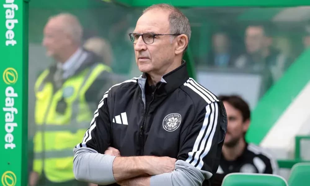Celtic manager observing from the sideline Celtic manager observing from the sideline